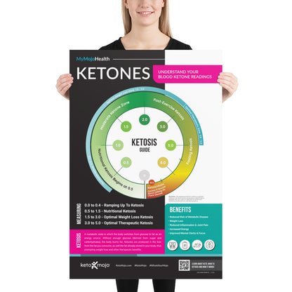 Cartel de las zonas cetónicas